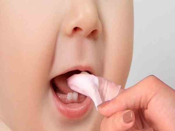  Dùng nước muối sinh lý chữa nấm miệng