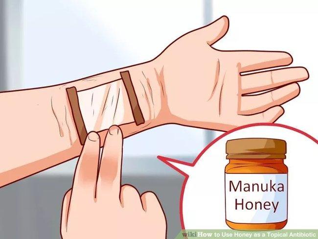 Thoa mật ong – Làm dịu vết thương và kháng khuẩn