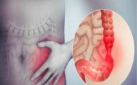 mẹo chữa đại tiện khó