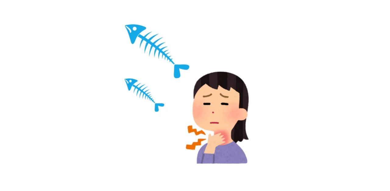 Ăn bơ thực vật chữa hóc xương cá ở cổ