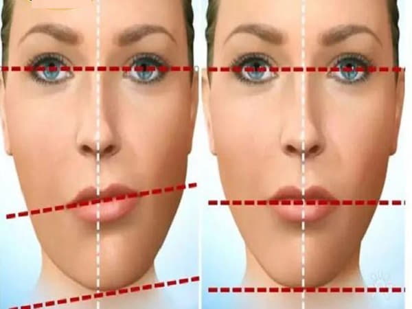Đặc điểm tướng mặt lệch